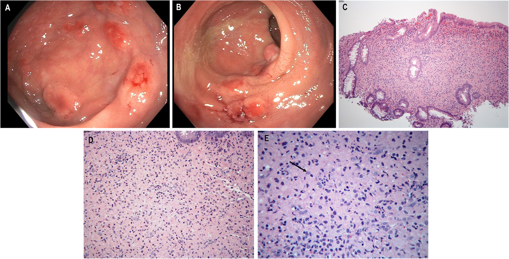 Fig. 1