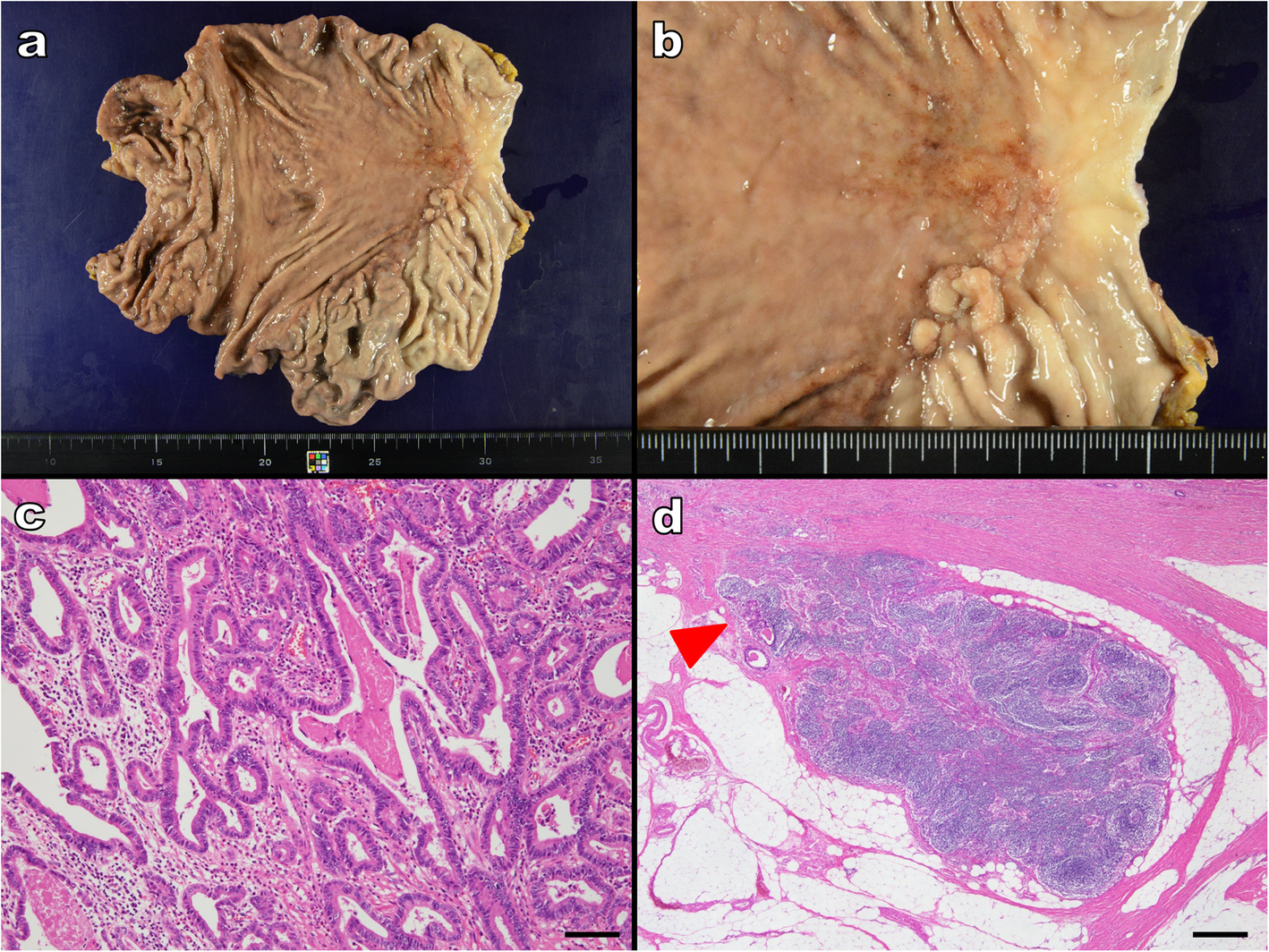 Fig. 4