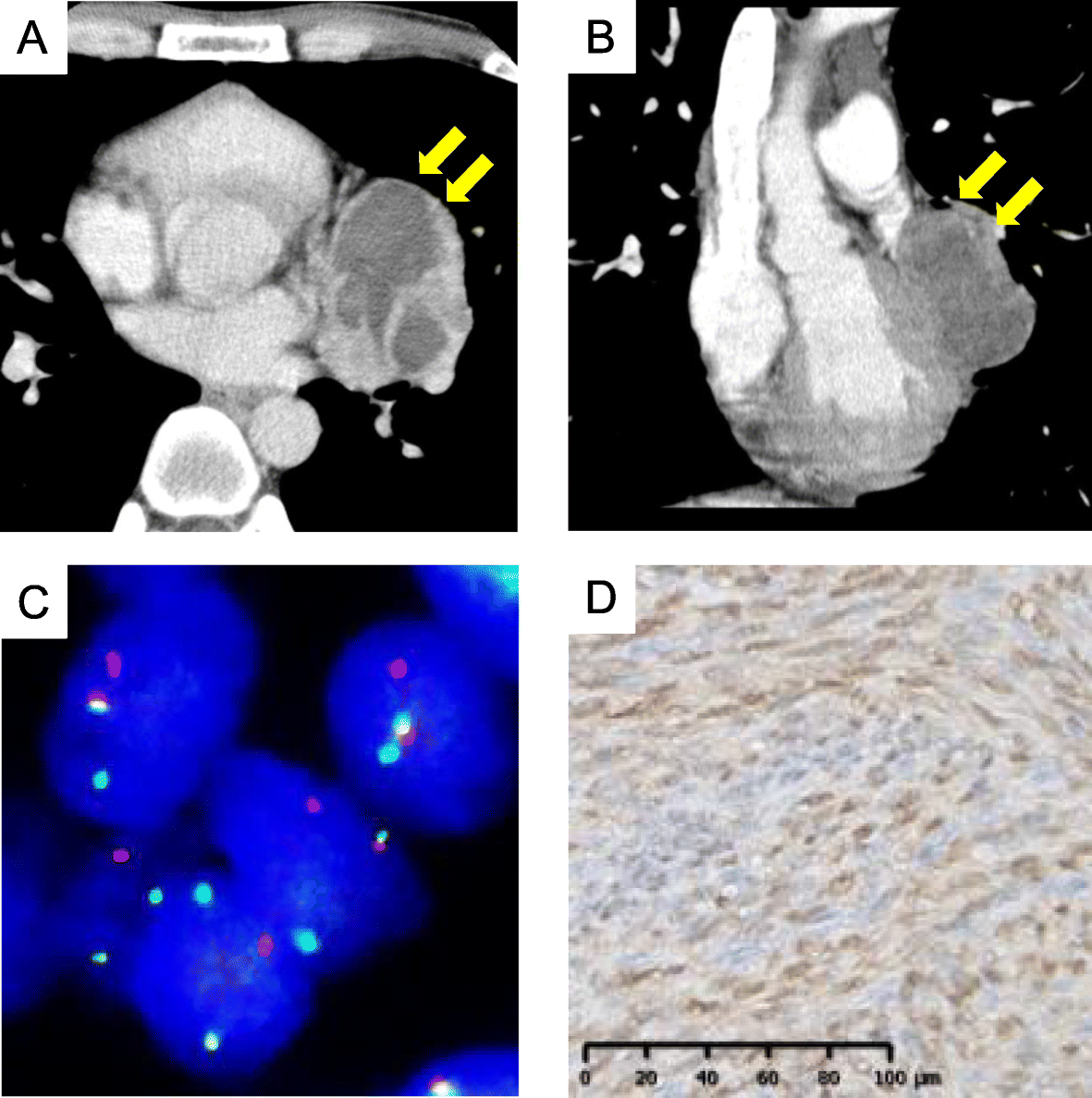 Fig. 2