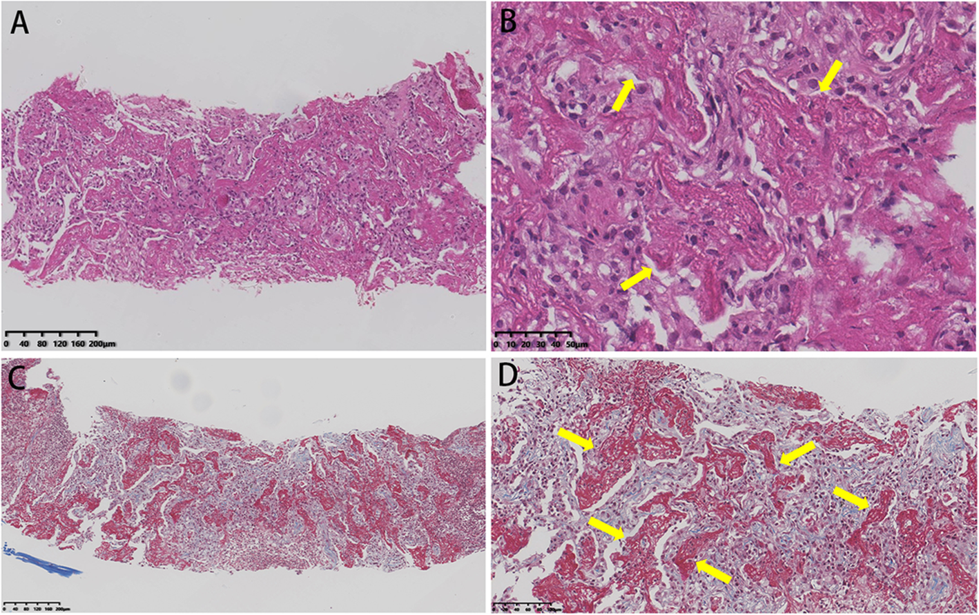 Fig. 4