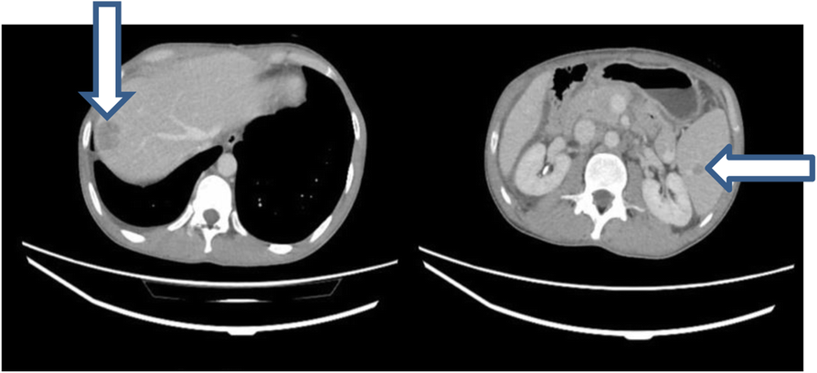 Fig. 1