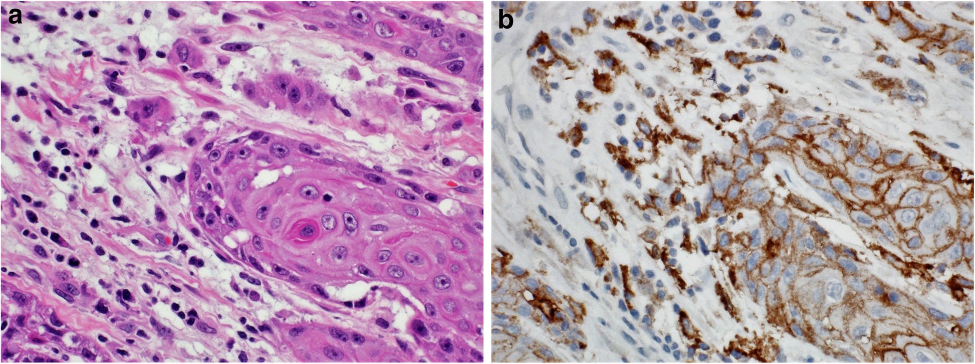 Fig. 12