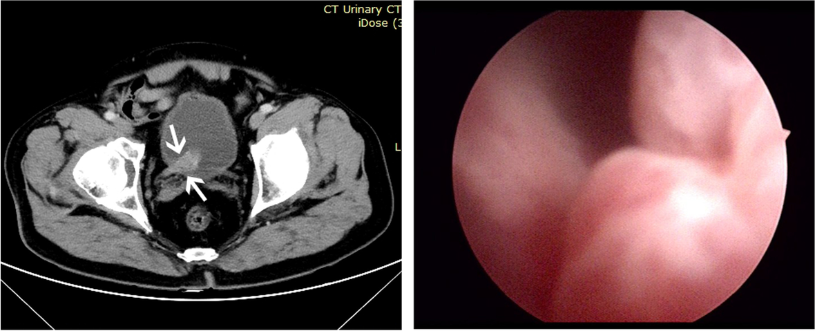 Fig. 1