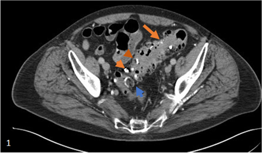 Fig. 1