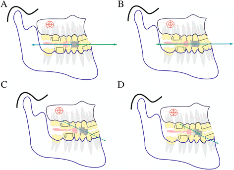 Fig 5