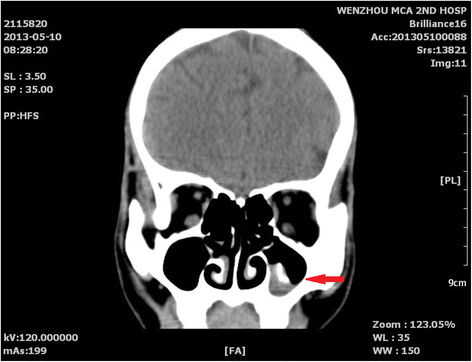 Fig. 1