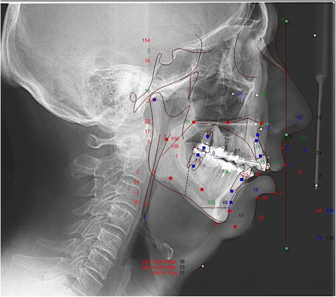 Fig. 2