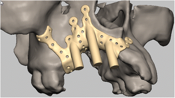 Fig. 3