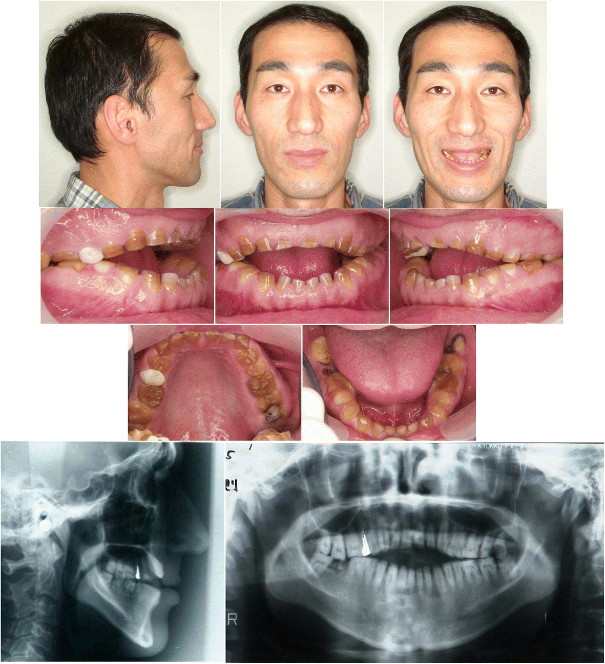 Fig. 1