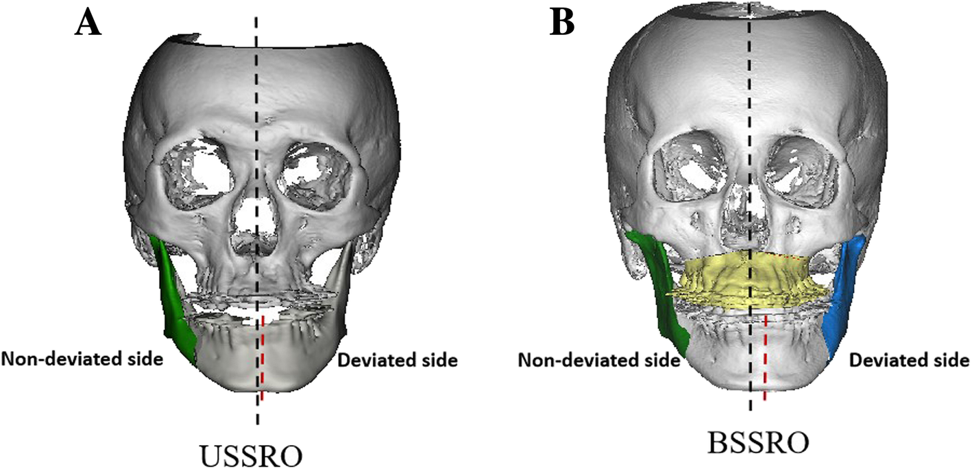 kin #mandelacatalougeevelin #omoirBasil #orthoshroud