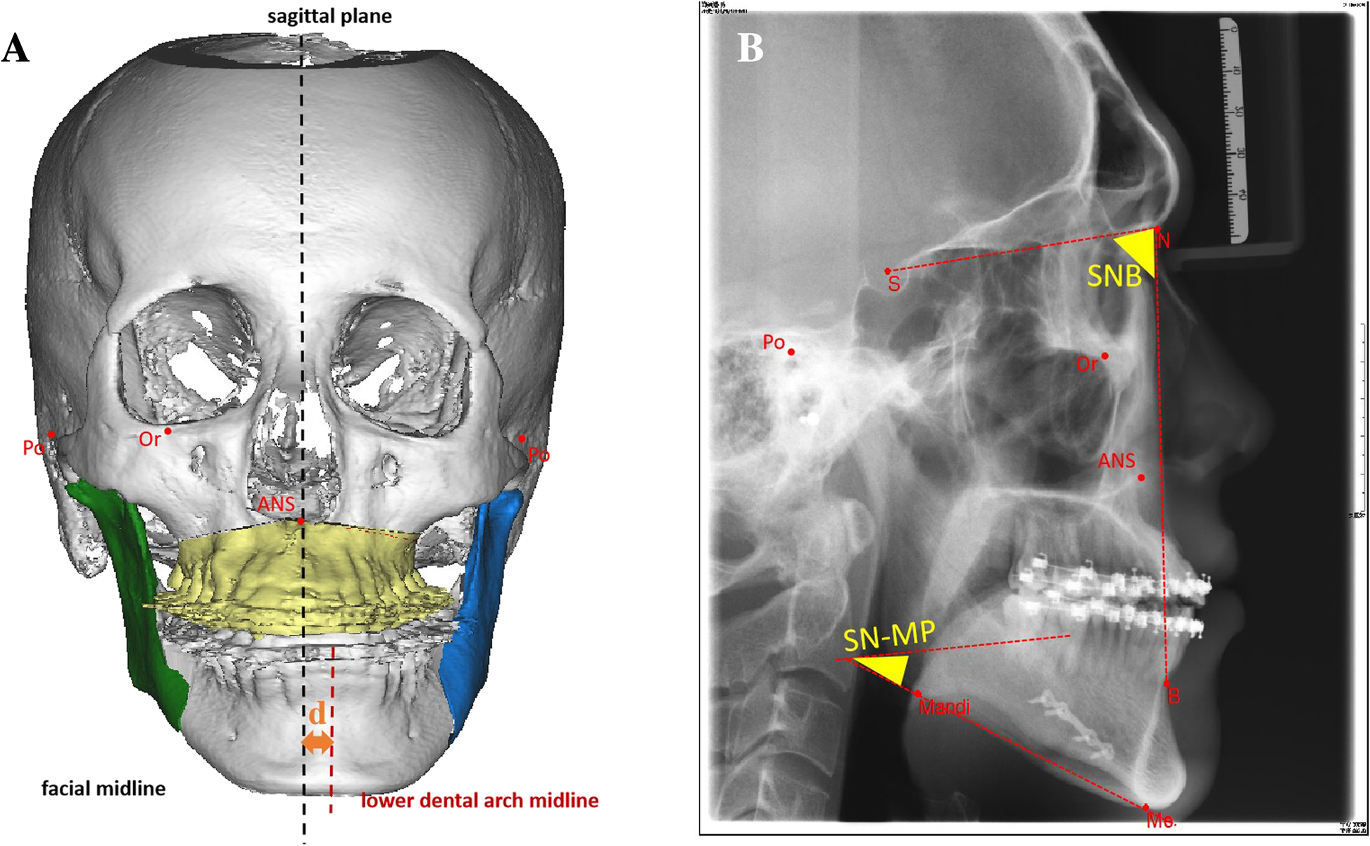 Fig. 4