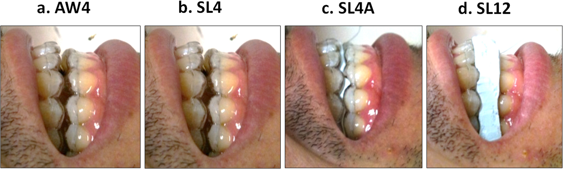 Fig. 4