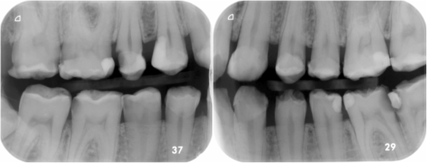 Fig. 5