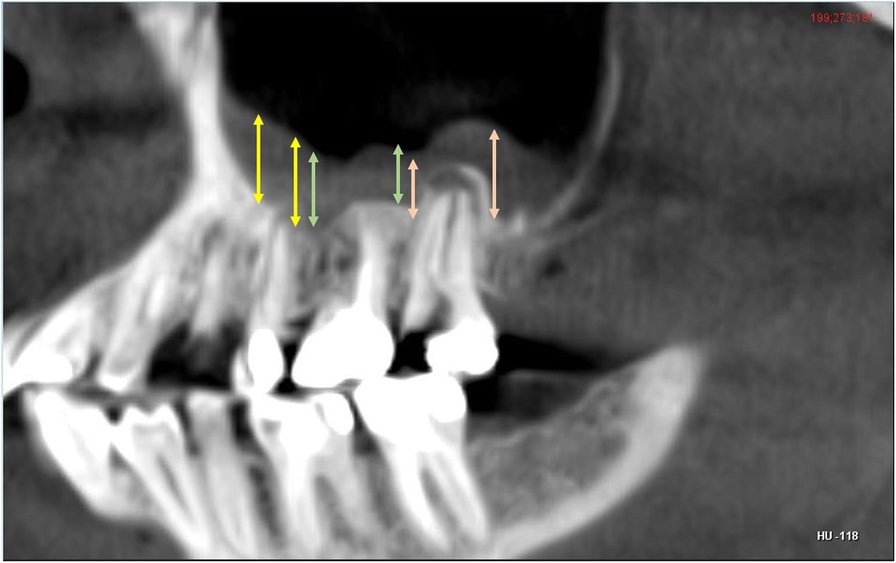 Fig. 5