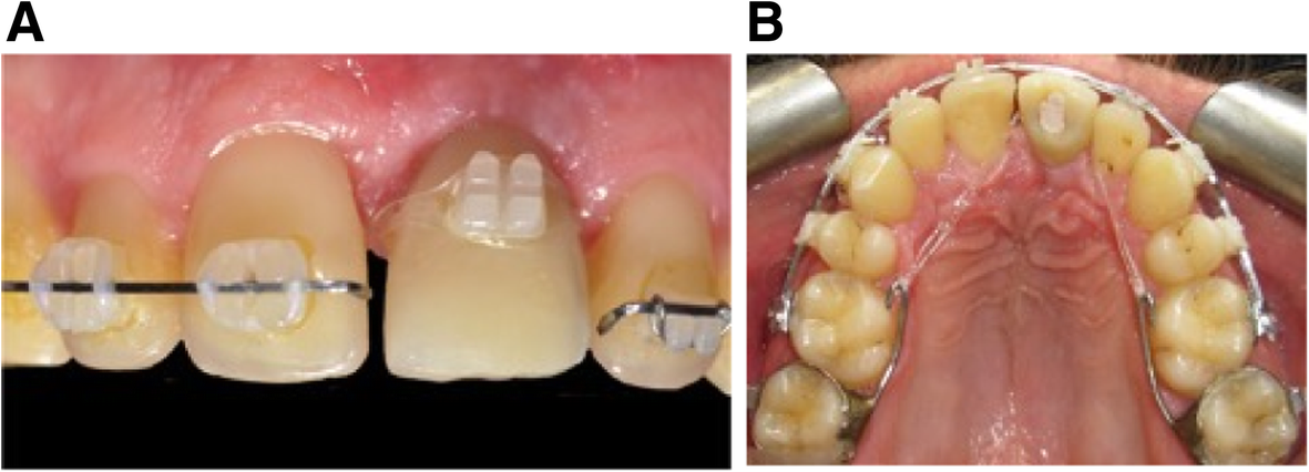 Fig. 11