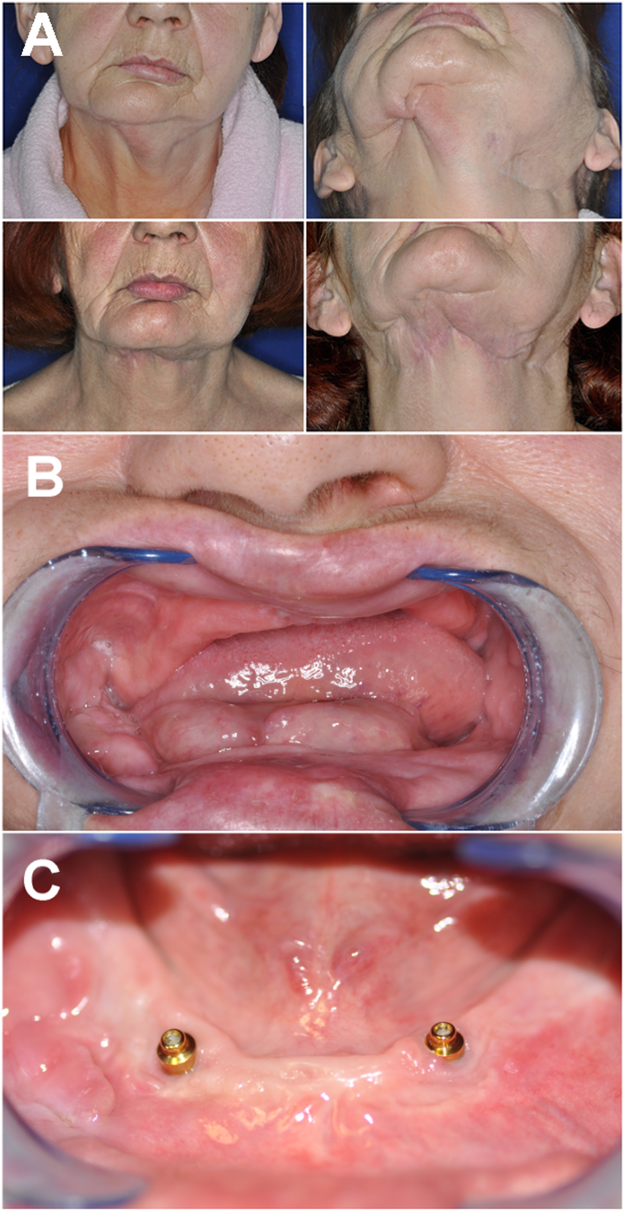 Fig. 2