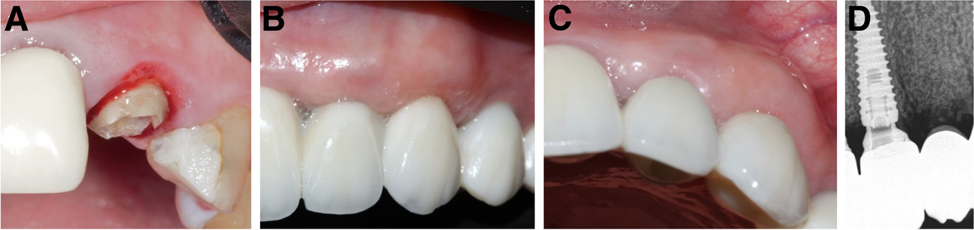 Fig. 13