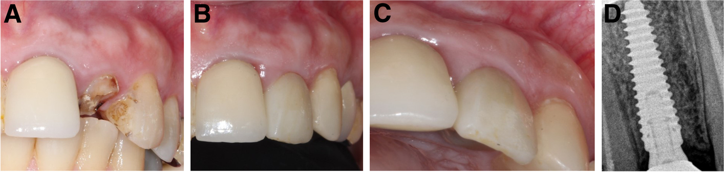 Fig. 5