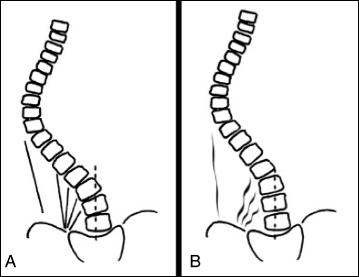 Fig. 82