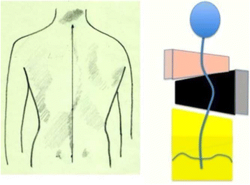 Fig. 19