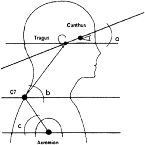 Fig. 30