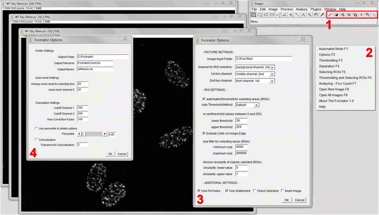 The Focinator A New Open Source Tool For High Throughput