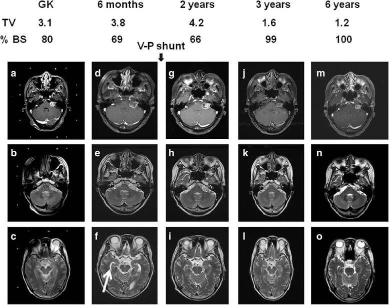 Fig. 6