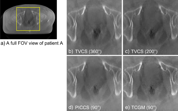 Fig. 9