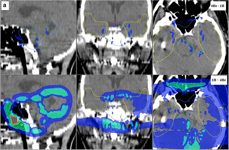 Fig. 4