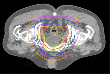 Fig. 2