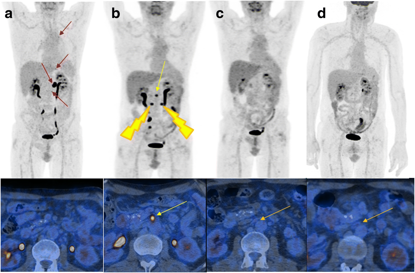 Fig. 1