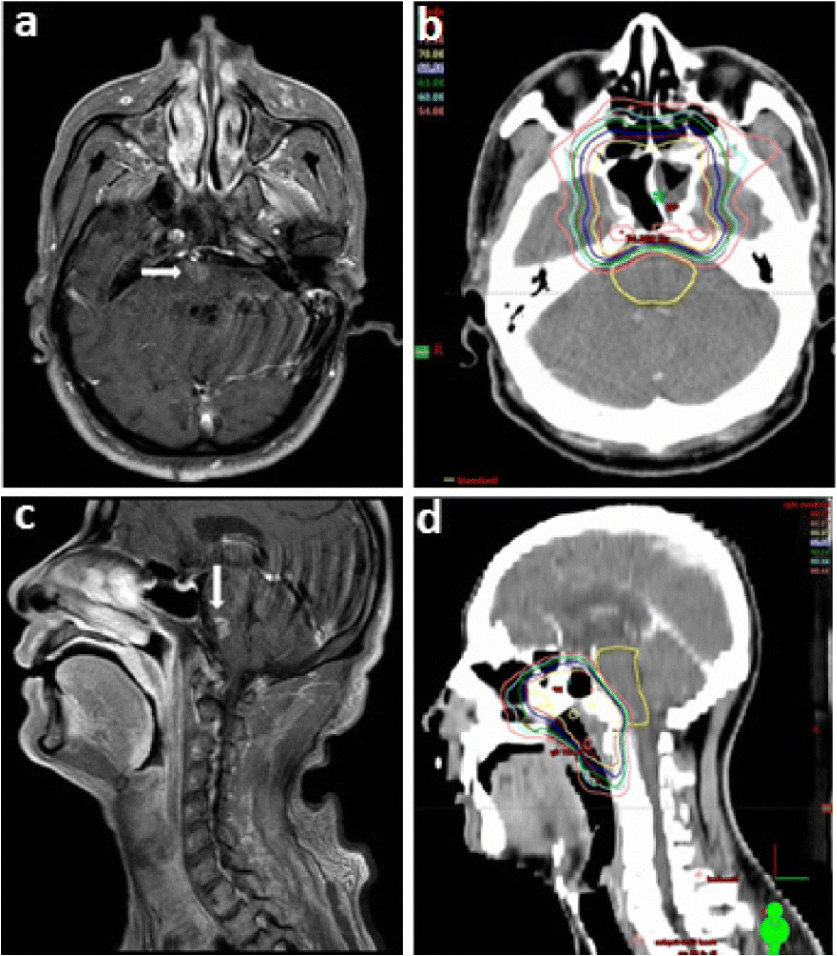 Fig. 2