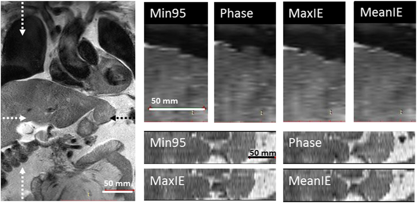 Fig. 6