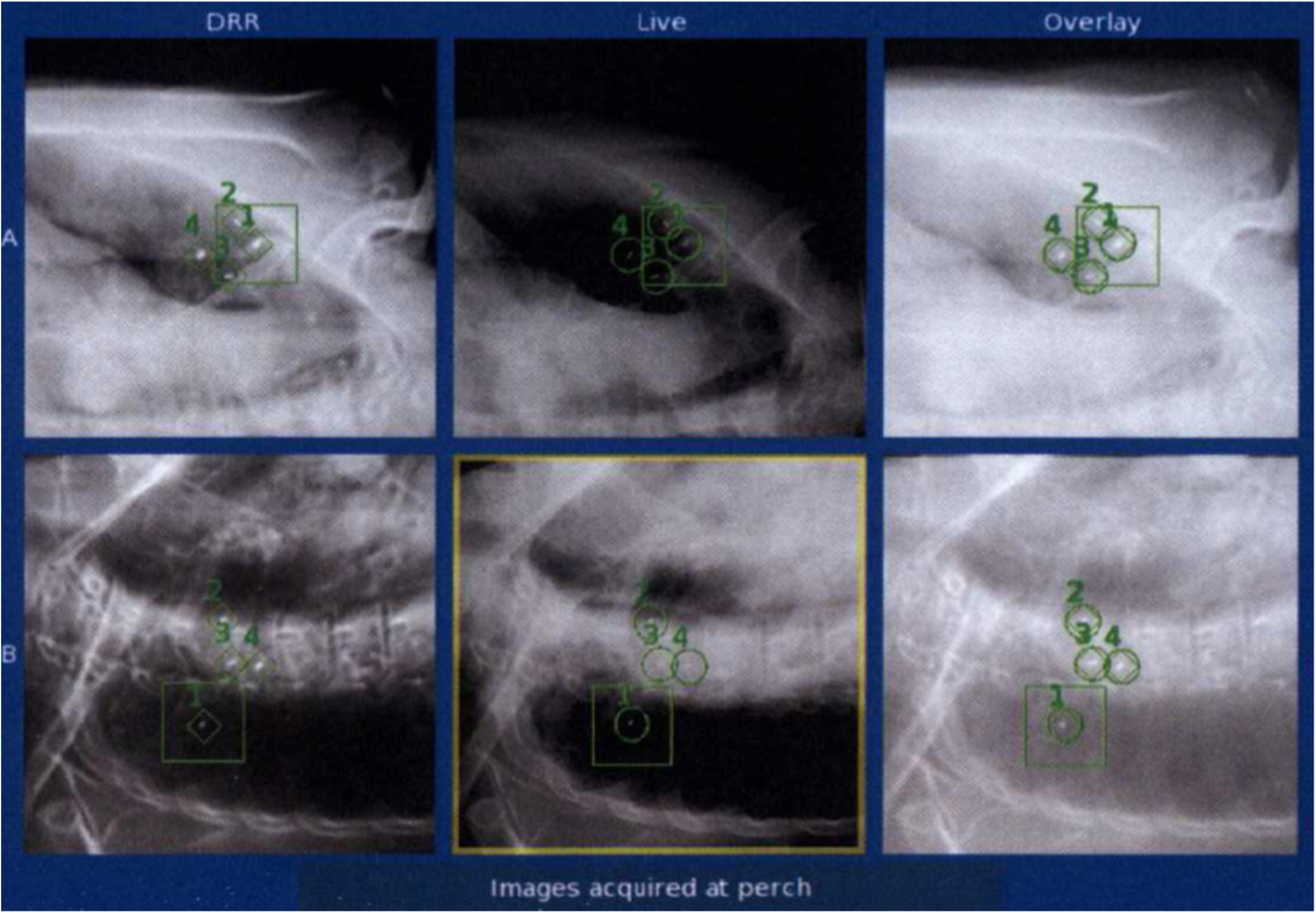 Fig. 4