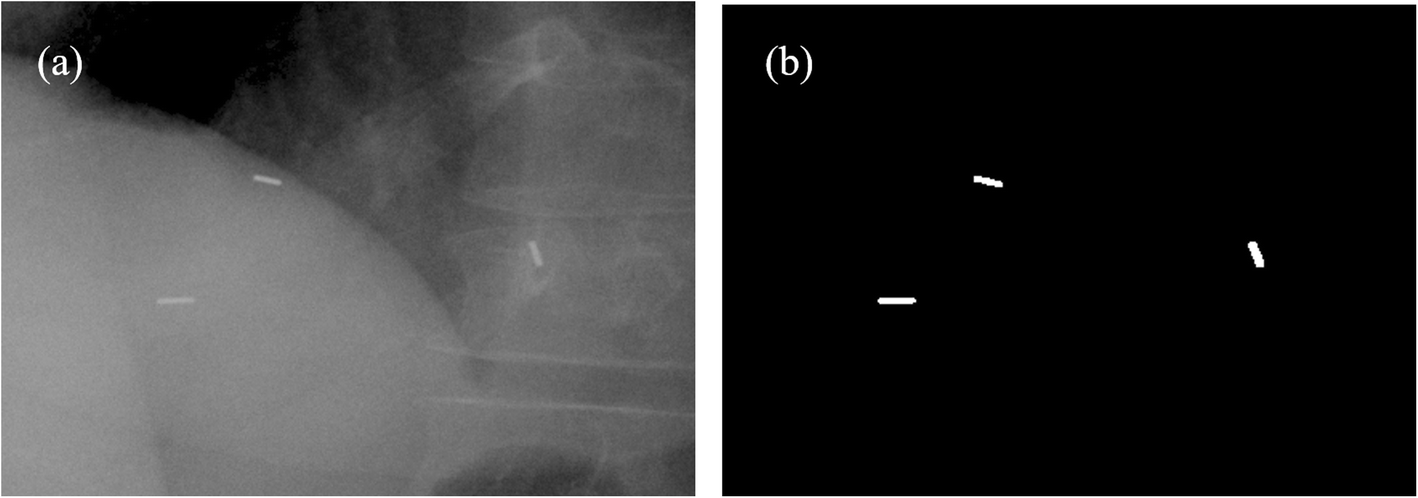 Fig. 2