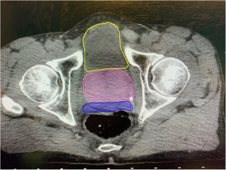 Fig. 5