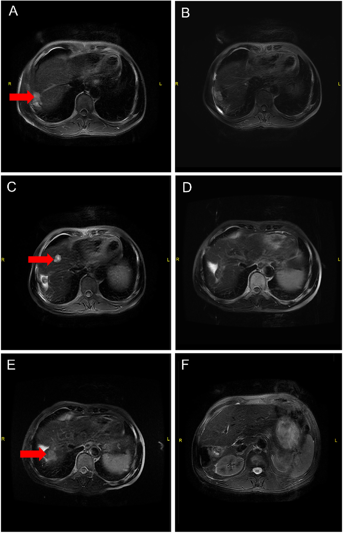 Fig. 5