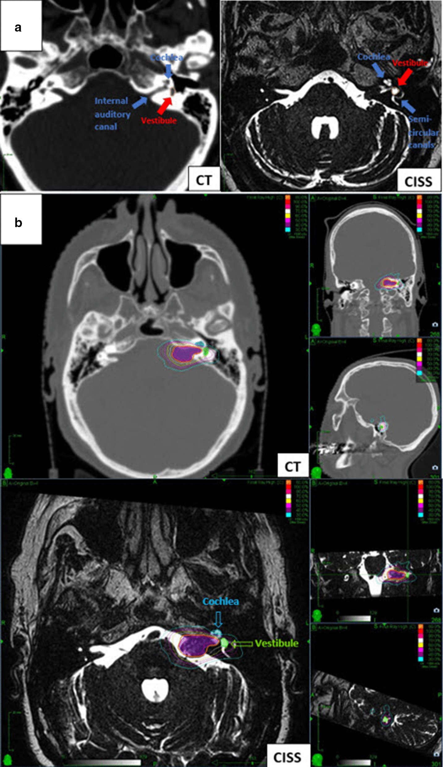 Figure1