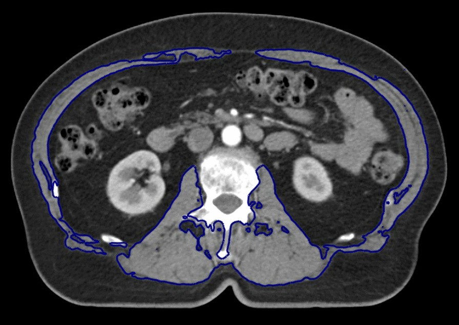 Fig. 3