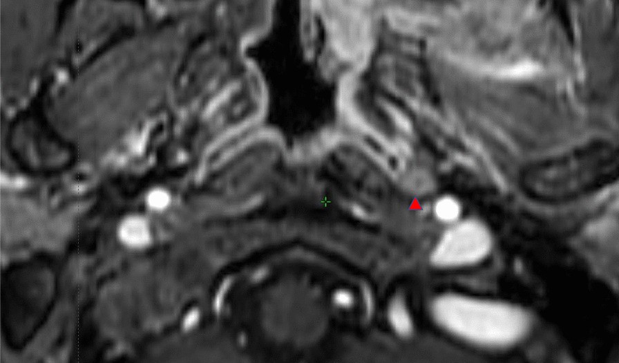 Fig. 1