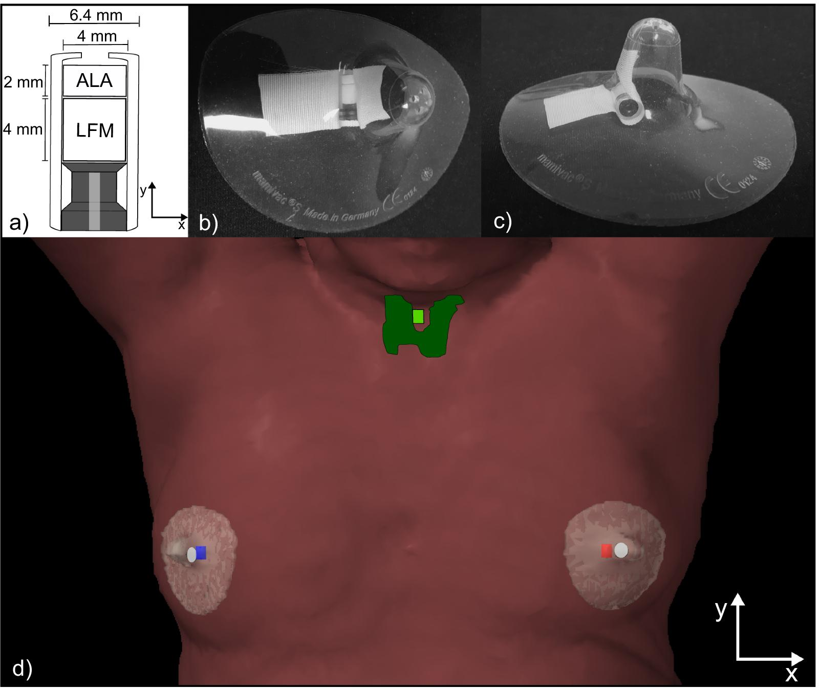 Fig. 1