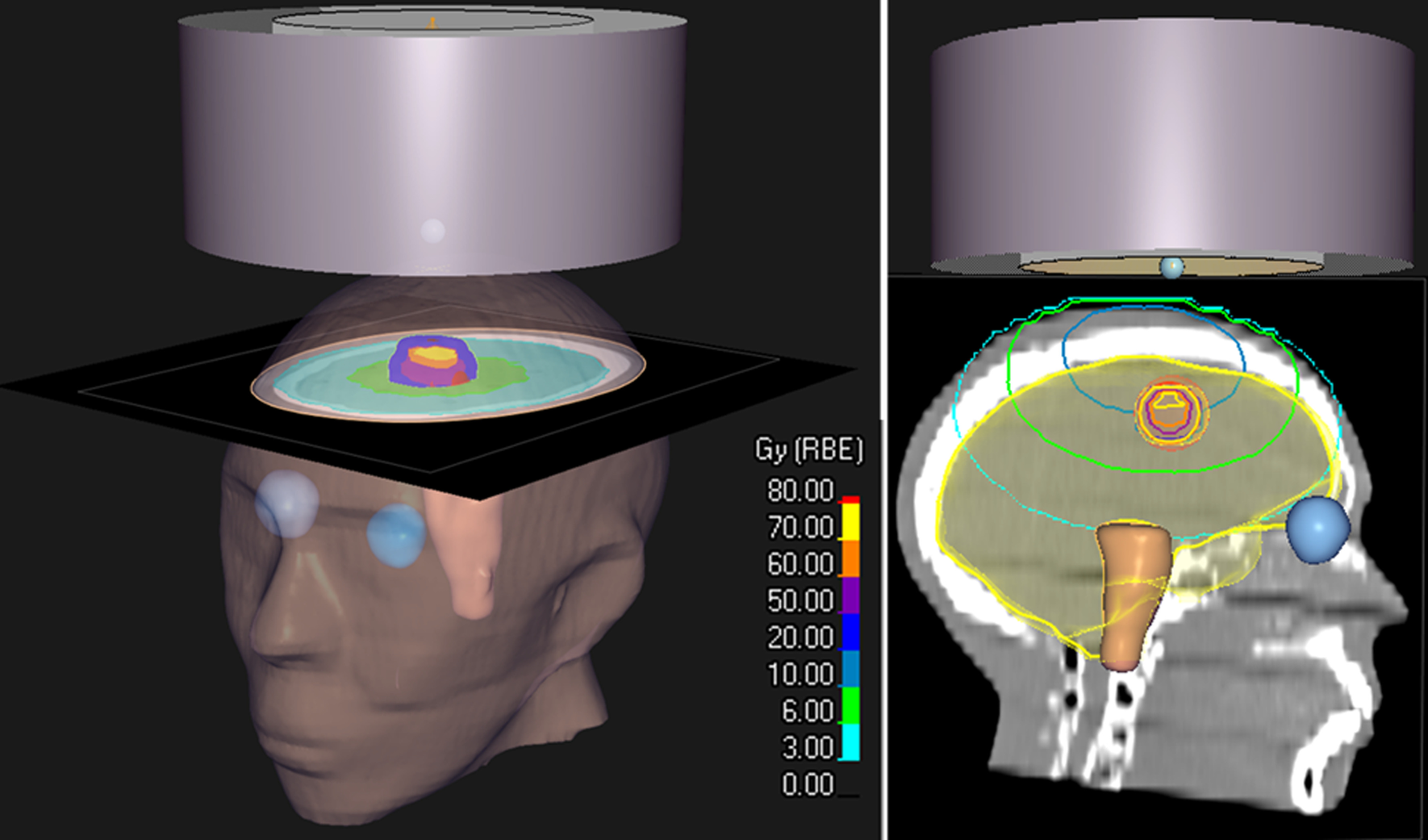 Fig. 11