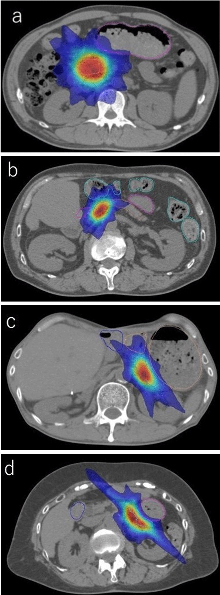 Fig. 1