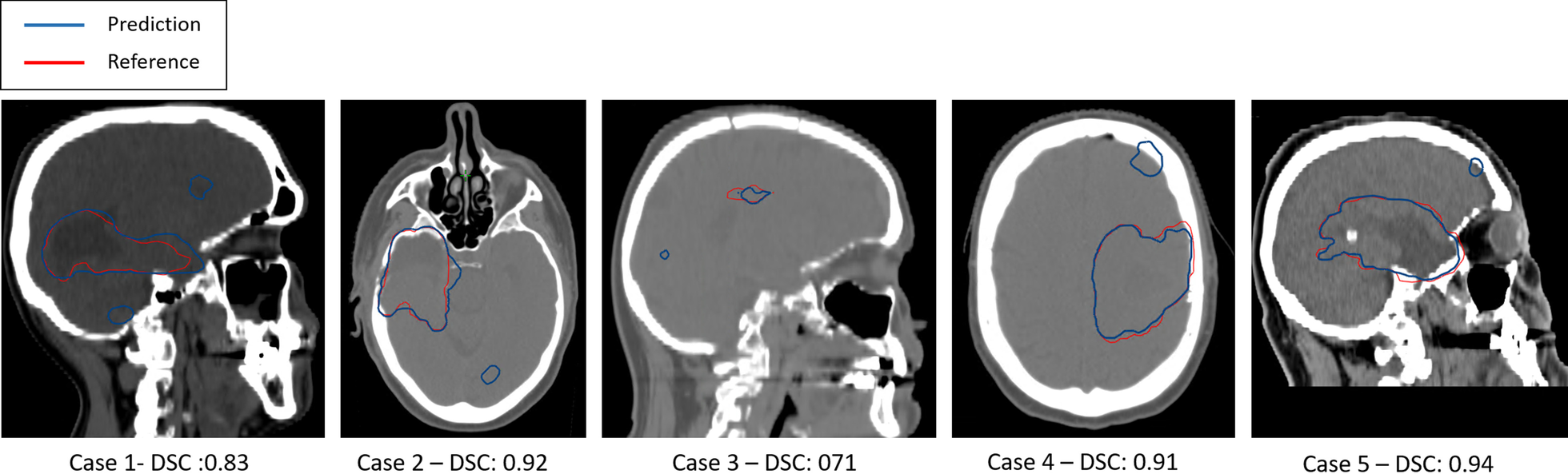 Fig. 15