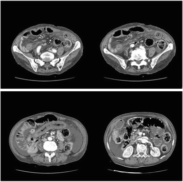 Fig 2