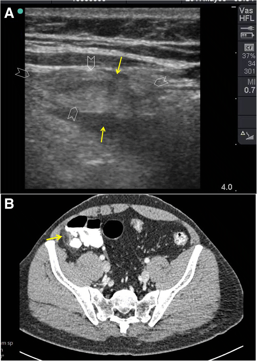 Fig. 10