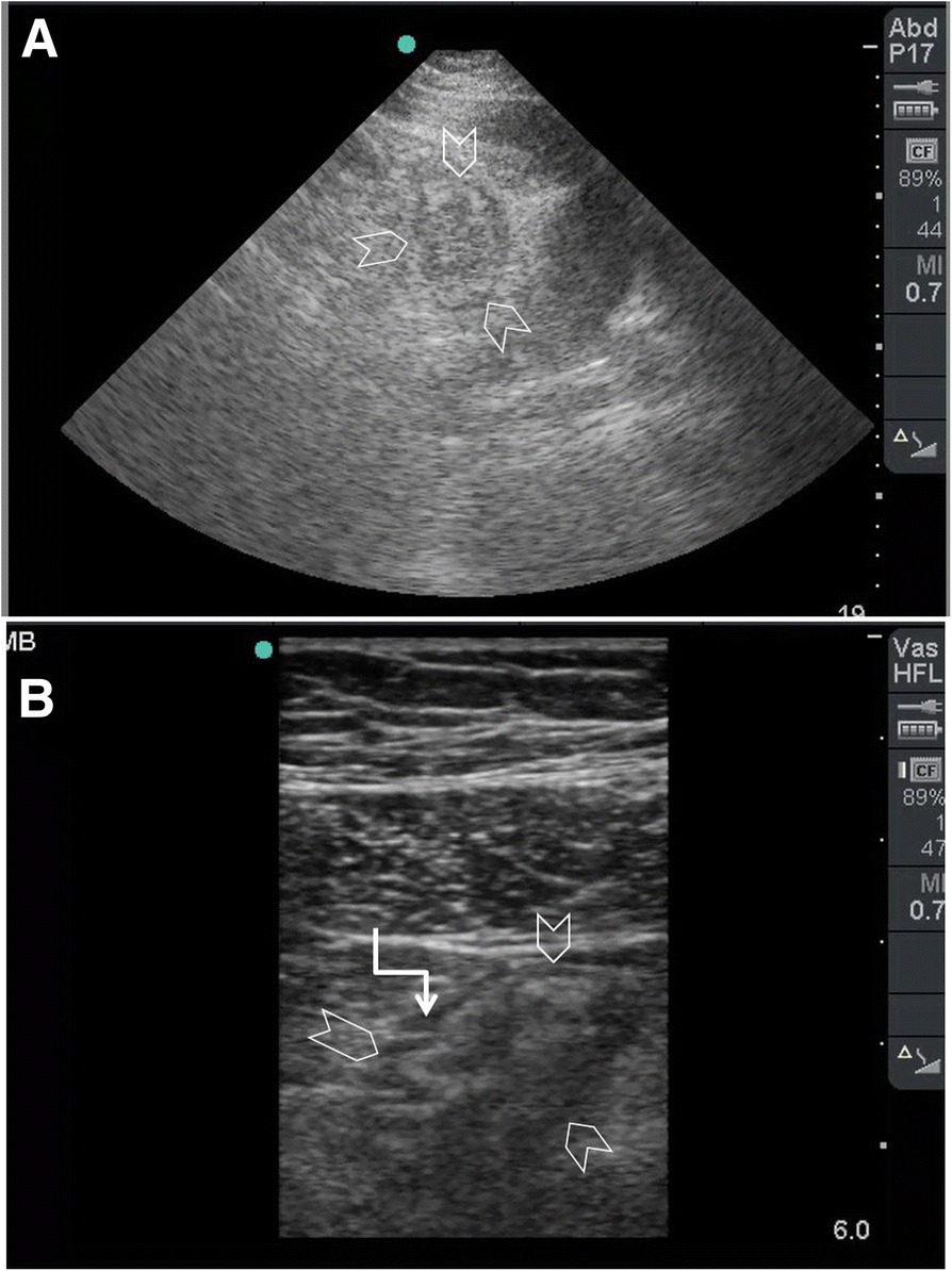 Fig. 11