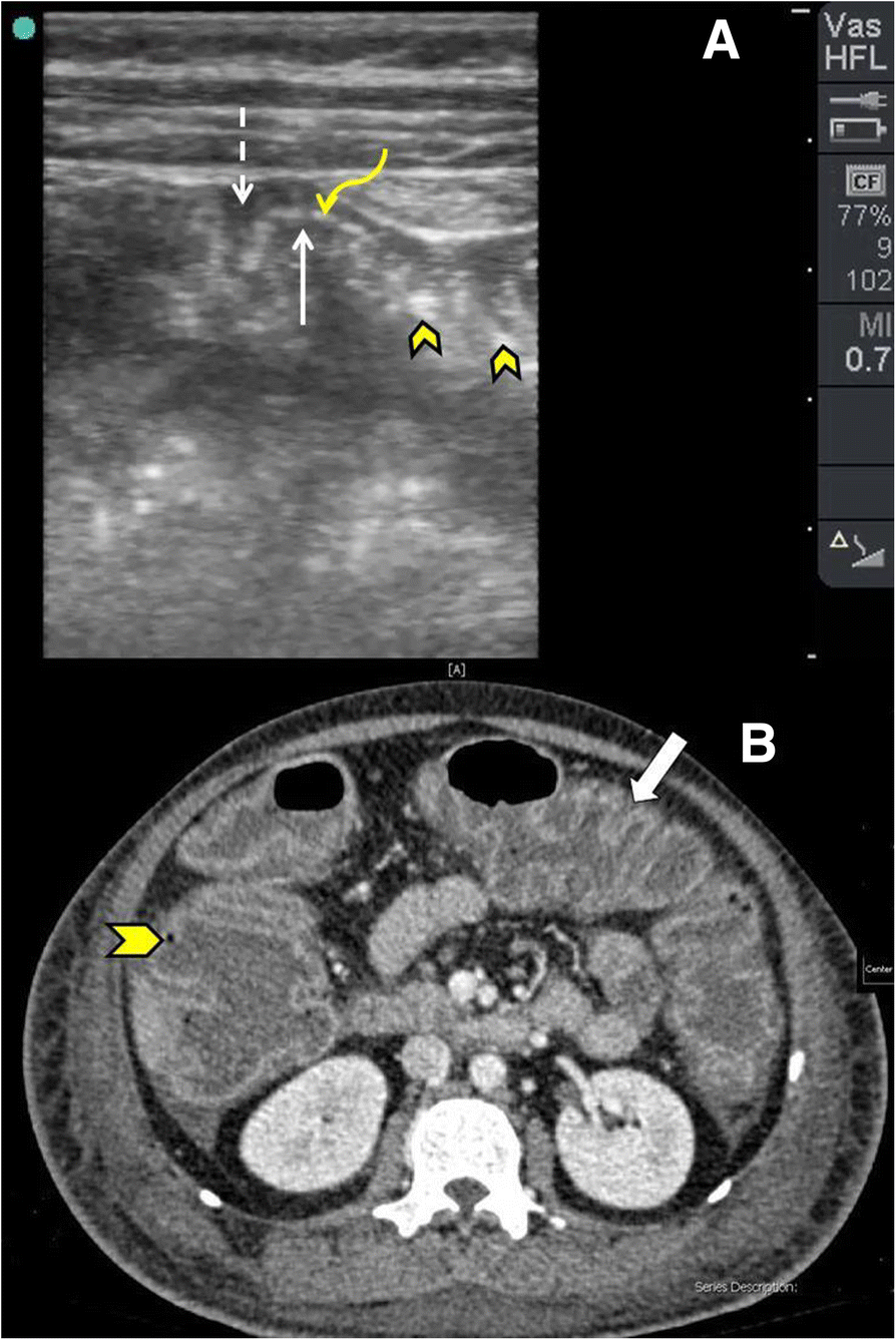 Fig. 12