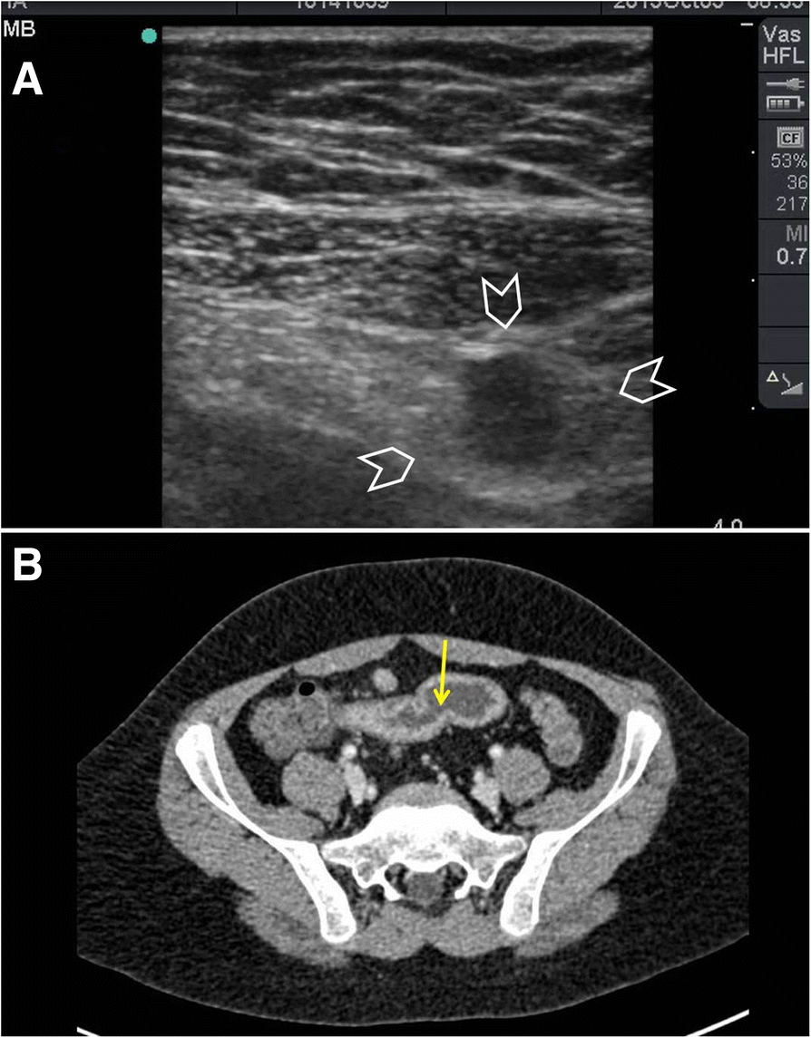 Fig. 14