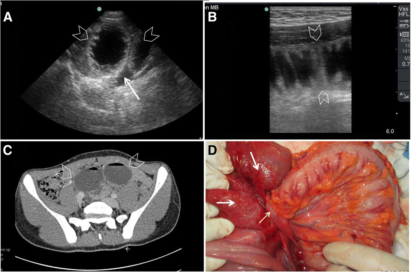 Fig. 6